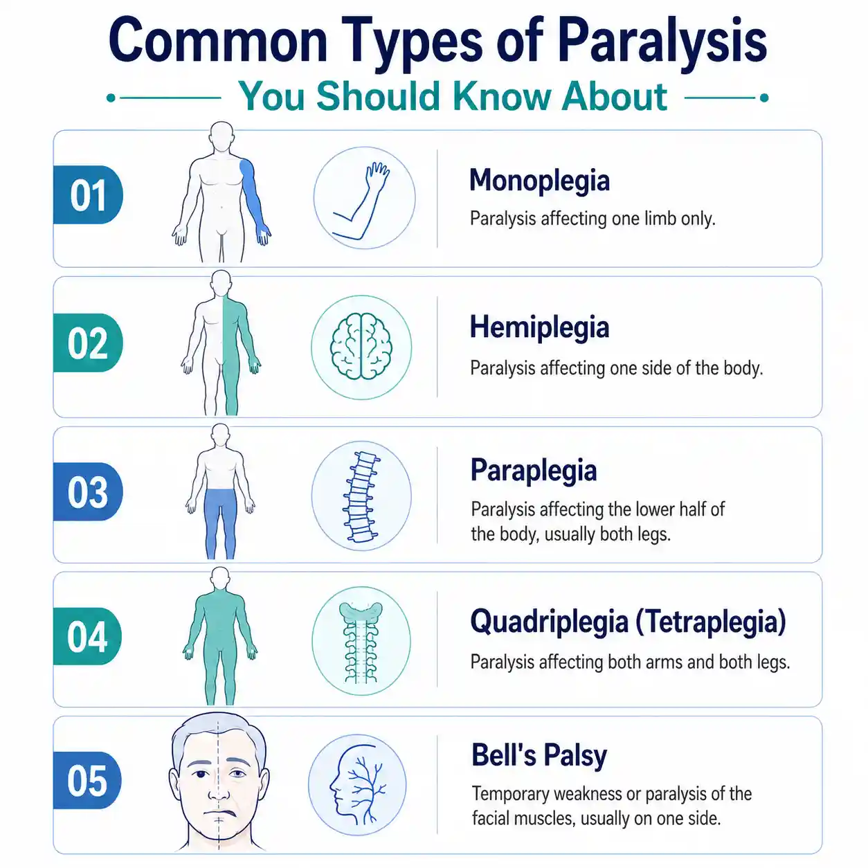 Common Types of Paralysis You Should Know About