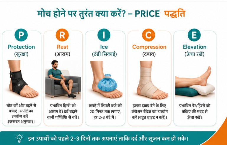 PRICE method for sprain treatment and first aid