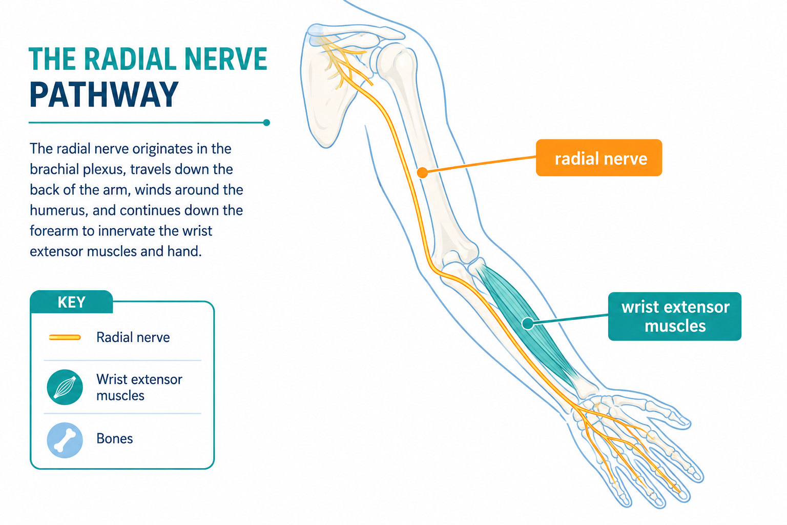 Medical illustration showing the radial nerve pathway from the shoulder to the hand and the wrist extensor muscles.