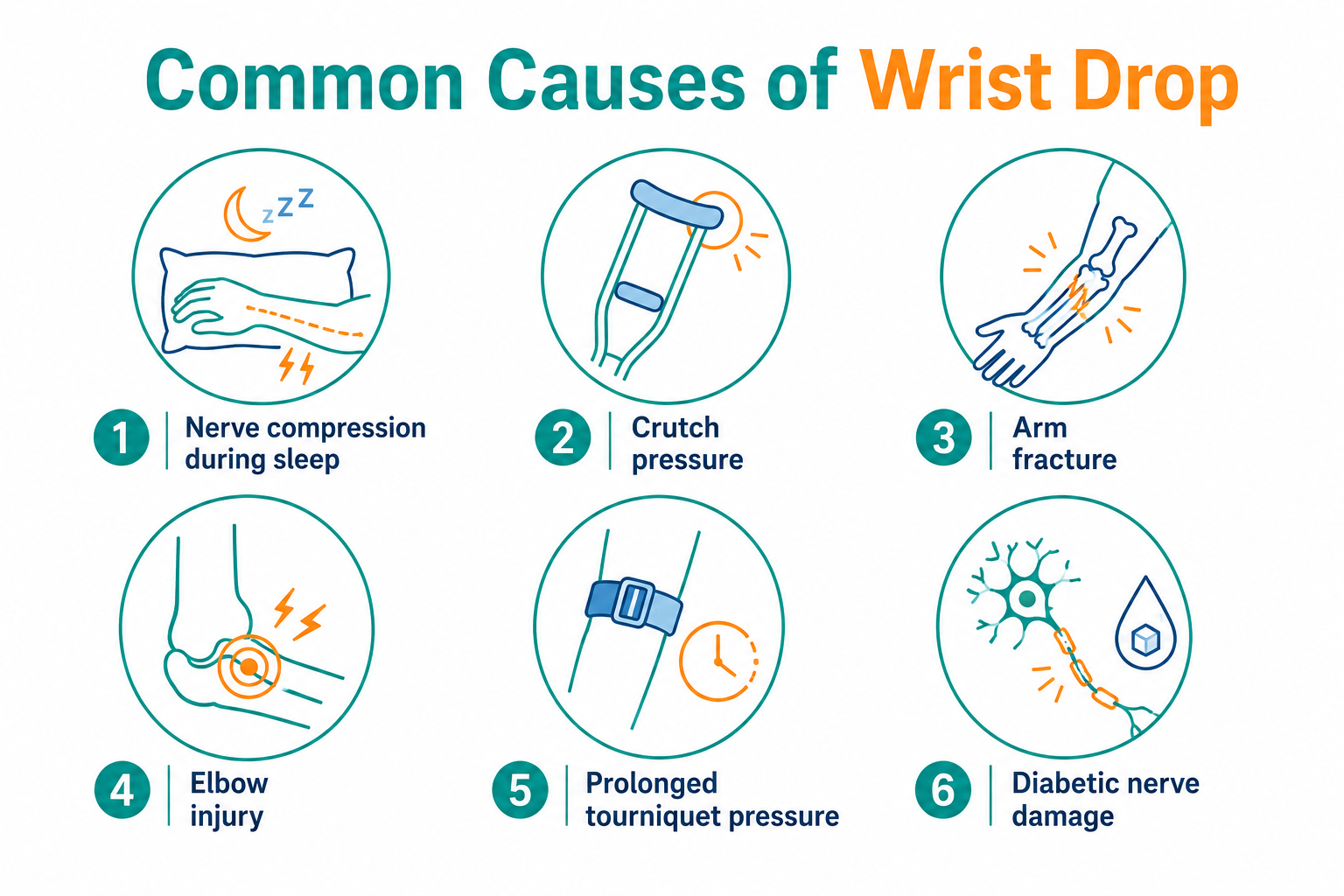 Infographic showing common causes of wrist drop, including nerve compression, crutch pressure, arm fracture, elbow injury, tourniquet pressure and diabetic nerve damage.