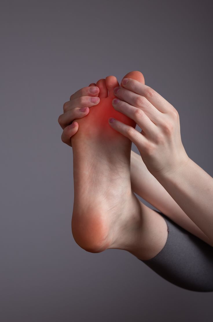 Plantar fasciitis physiotherapy and heel pain rehabilitation at Apricot Care Pune